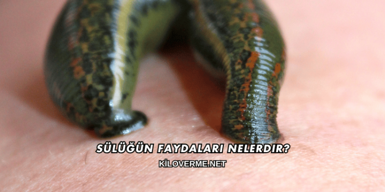 Sülüğün Faydaları Nelerdir?