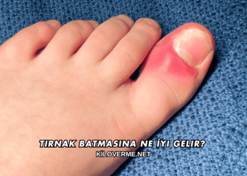 Tırnak Batmasına Ne İyi Gelir?