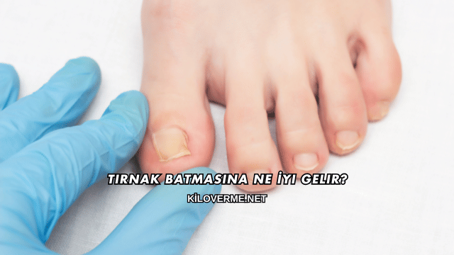 Tırnak Batmasına Ne İyi Gelir?