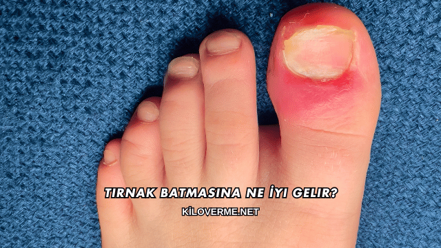 Tırnak Batmasına Ne İyi Gelir?