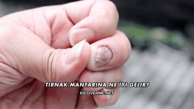 Tırnak Mantarına Ne İyi Gelir?
