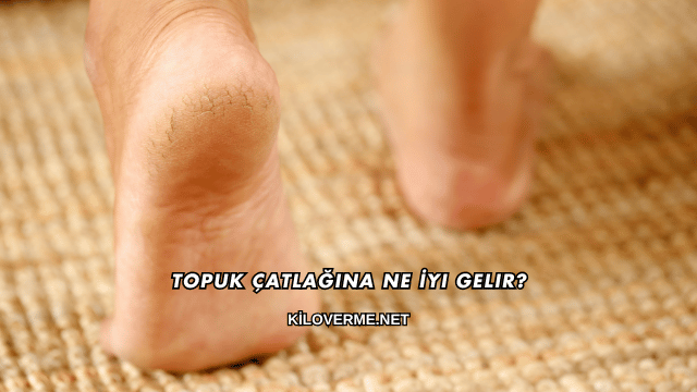 Topuk Çatlağına Ne İyi Gelir?