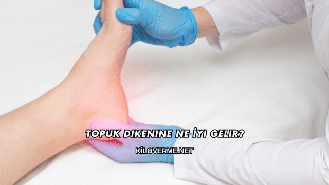 Topuk Dikenine Ne İyi Gelir?