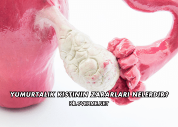 Yumurtalık Kistinin Zararları Nelerdir?