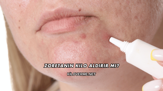 Zoretanin Kilo Aldırır mı?