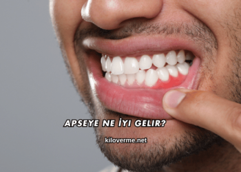 Apseye Ne İyi Gelir?