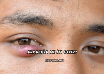 Arpacığa Ne İyi Gelir?