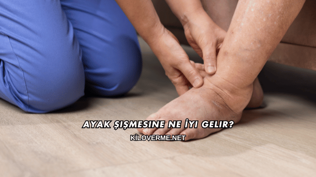 Ayak Şişmesine Ne İyi Gelir?