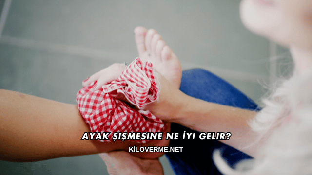 Ayak Şişmesine Ne İyi Gelir?