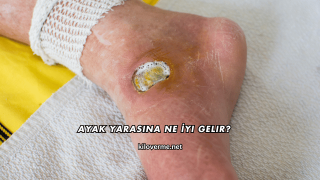 Ayak Yarasına Ne İyi Gelir?