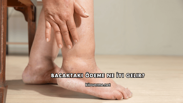 Bacaktaki Ödeme Ne İyi Gelir?