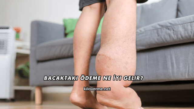 Bacaktaki Ödeme Ne İyi Gelir?