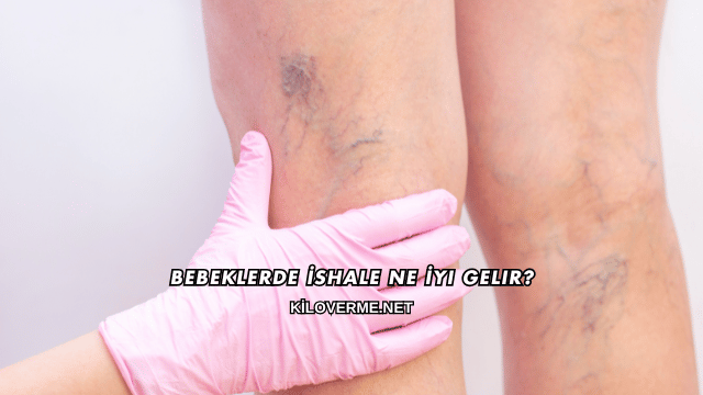 Bebeklerde İshale Ne İyi Gelir
