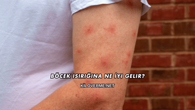 Böcek Isırığına Ne İyi Gelir?
