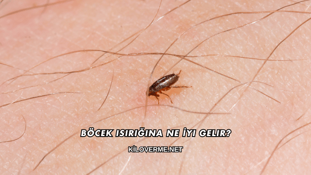 Böcek Isırığına Ne İyi Gelir?