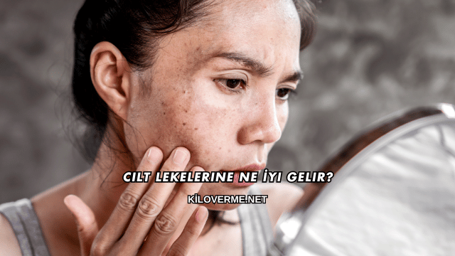 Cilt Lekelerine Ne İyi Gelir?