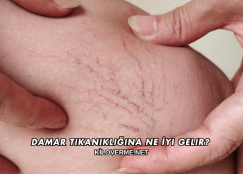 Damar Tıkanıklığına Ne İyi Gelir?