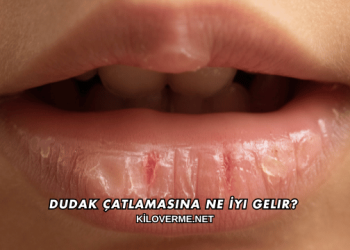 Dudak Çatlamasına Ne İyi Gelir?