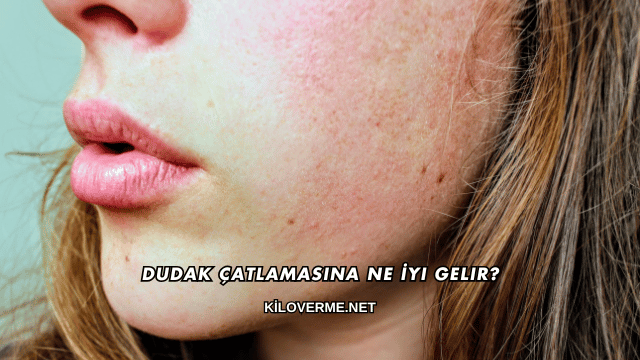 Dudak Çatlamasına Ne İyi Gelir?