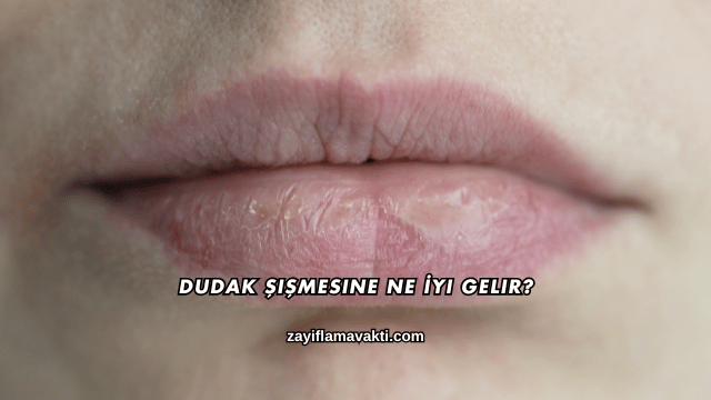 Dudak Şişmesine Ne İyi Gelir?