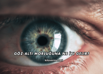 Göz Altı Morluğuna Ne İyi Gelir?