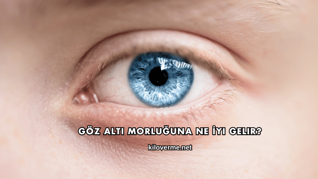 Göz Altı Morluğuna Ne İyi Gelir?