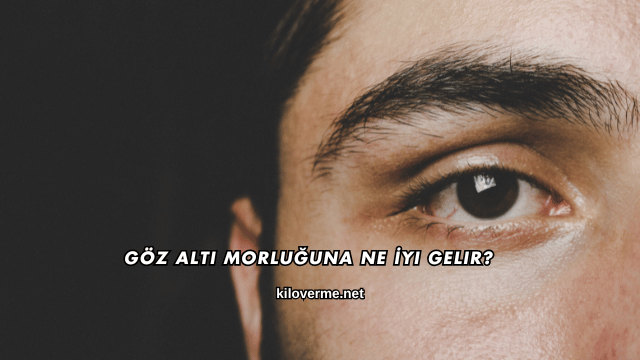 Göz Altı Morluğuna Ne İyi Gelir?