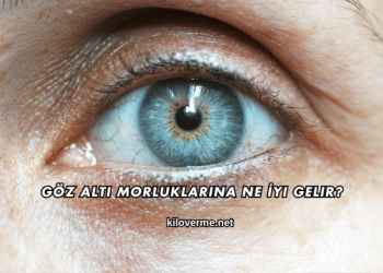 Göz Altı Morluklarına Ne İyi Gelir?