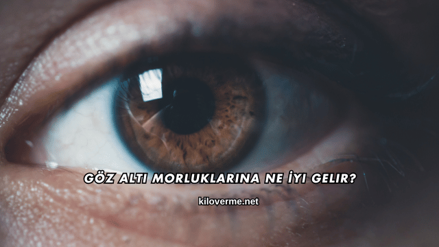Göz Altı Morluklarına Ne İyi Gelir?