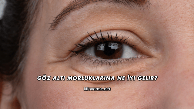 Göz Altı Morluklarına Ne İyi Gelir?