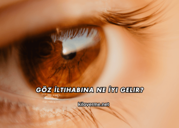 Göz İltihabına Ne İyi Gelir?