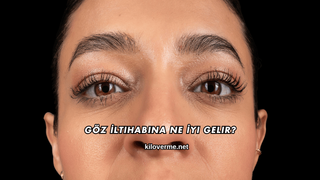 Göz İltihabına Ne İyi Gelir?
