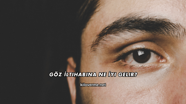 Göz İltihabına Ne İyi Gelir?