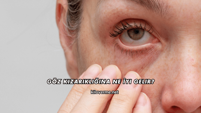 Göz Kızarıklığına Ne İyi Gelir?