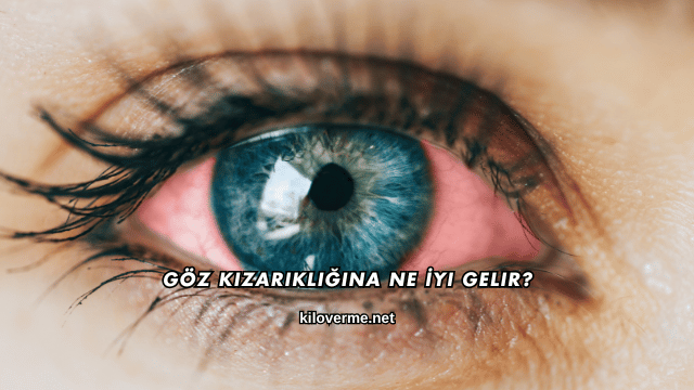 Göz Kızarıklığına Ne İyi Gelir?
