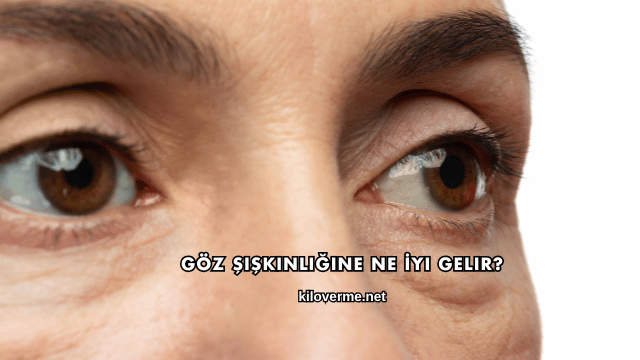 Göz Şişkinliğine Ne İyi Gelir?