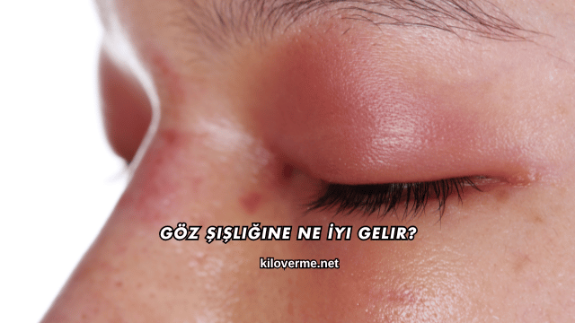 Göz Şişliğine Ne İyi Gelir?