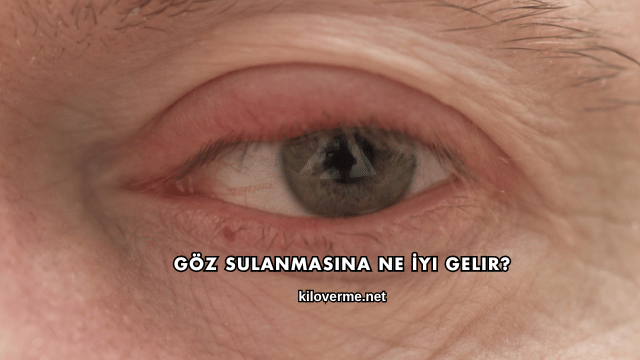 Göz Sulanmasına Ne İyi Gelir?