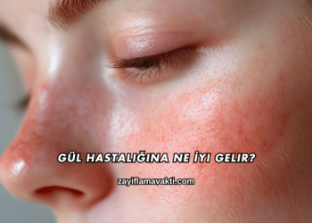 Gül Hastalığına Ne İyi Gelir?