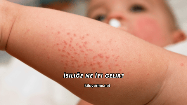 İsiliğe Ne İyi Gelir?