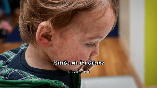 İsiliğe Ne İyi Gelir?