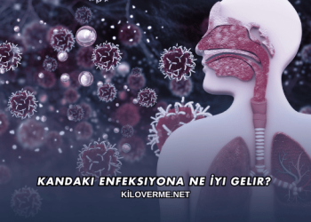 Kandaki Enfeksiyona Ne İyi Gelir?