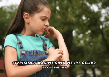 Sivrisinek Kaşıntısına Ne İyi Gelir?