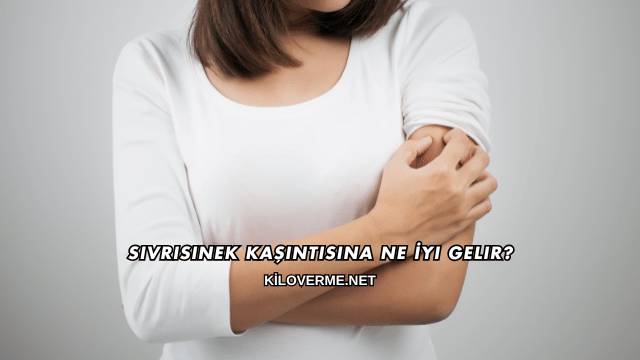 Sivrisinek Kaşıntısına Ne İyi Gelir?