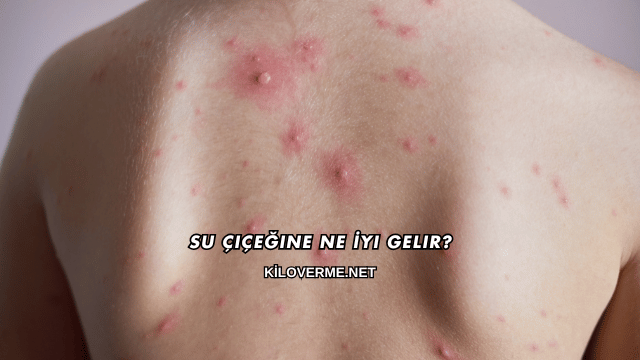 Su Çiçeğine Ne İyi Gelir?