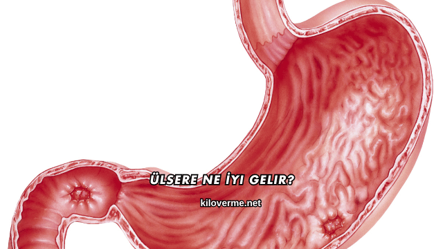 Ülsere Ne İyi Gelir?