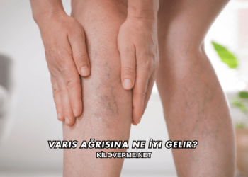 Varis Ağrısına Ne İyi Gelir?