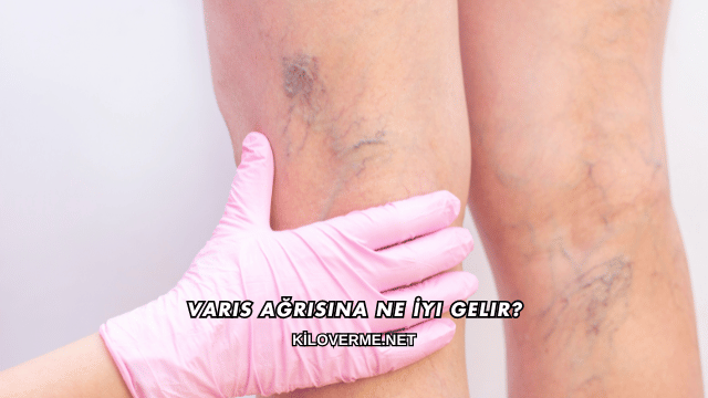 Varis Ağrısına Ne İyi Gelir?