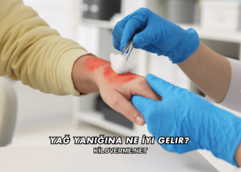 Yağ Yanığına Ne İyi Gelir?