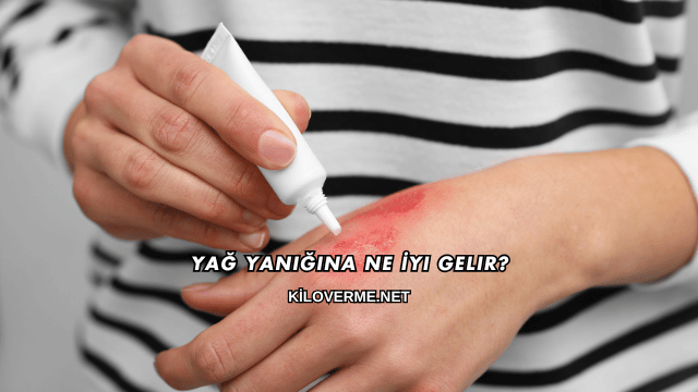 Yağ Yanığına Ne İyi Gelir?
